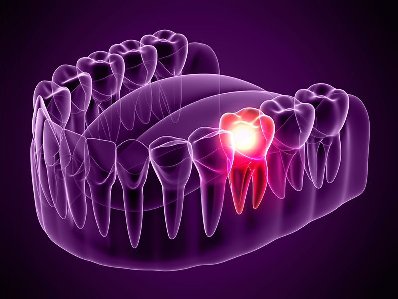 Emergency toothache appointments