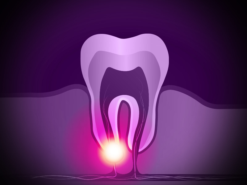 Tooth abscess appointments